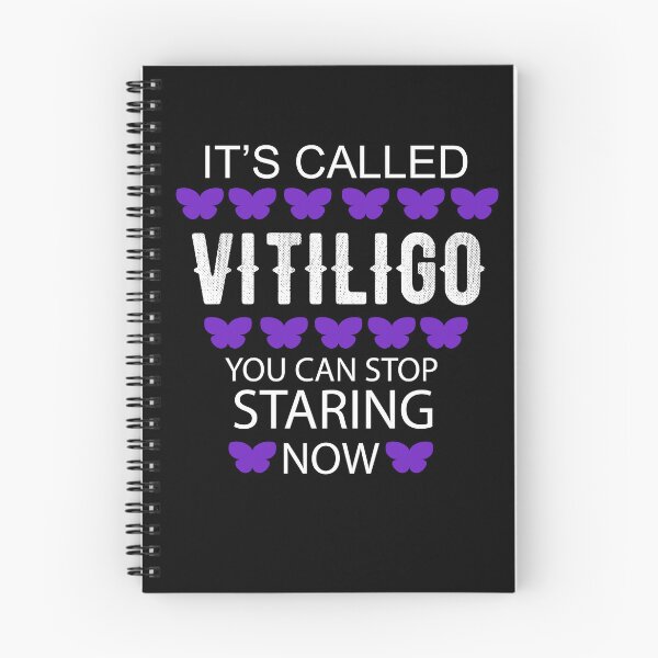 Item preview, It's called Vitiligo you can stop staring now - Vitiligo Raise Awareness   designed and sold by Raiko-art.