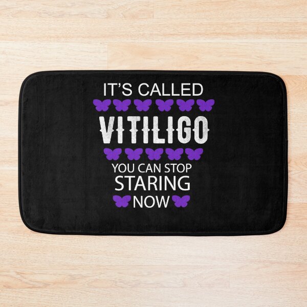 Item preview, It's called Vitiligo you can stop staring now - Vitiligo Raise Awareness   designed and sold by Raiko-art.