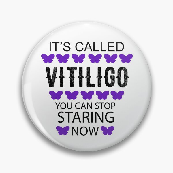 Item preview, It's called Vitiligo you can stop staring now - Vitiligo Raise Awareness   designed and sold by Raiko-art.