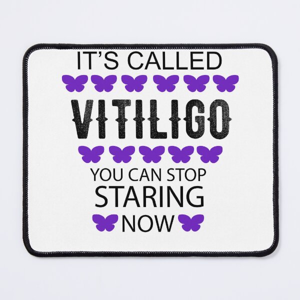 Item preview, It's called Vitiligo you can stop staring now - Vitiligo Raise Awareness designed and sold by Raiko-art.