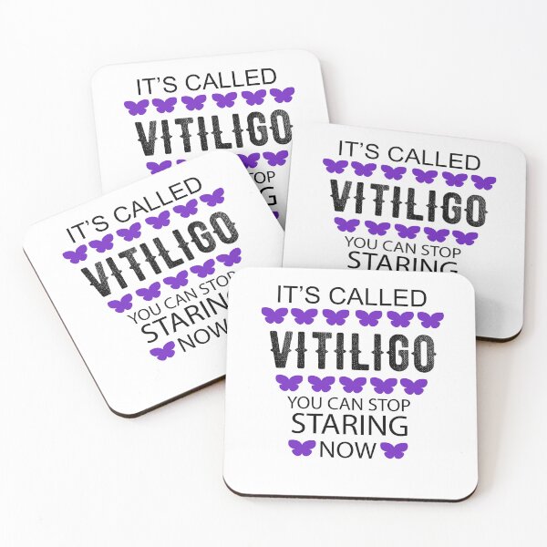 Item preview, It's called Vitiligo you can stop staring now - Vitiligo Raise Awareness   designed and sold by Raiko-art.