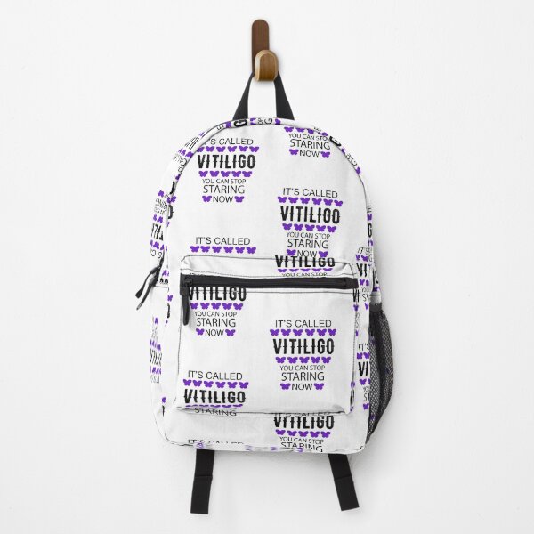 Item preview, It's called Vitiligo you can stop staring now - Vitiligo Raise Awareness designed and sold by Raiko-art.