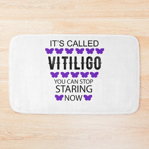 Item preview, It's called Vitiligo you can stop staring now - Vitiligo Raise Awareness   designed and sold by Raiko-art.