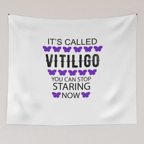 Item preview, It's called Vitiligo you can stop staring now - Vitiligo Raise Awareness   designed and sold by Raiko-art.
