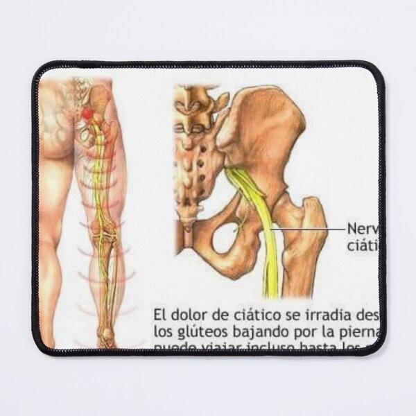 Item preview, aciatic nerve designed and sold by RenatoGuzman.
