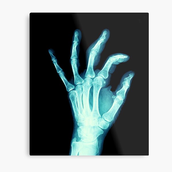 Funny X Ray Metal Prints for Sale | Redbubble Funny X Ray Metal Prints for Sale | Redbubble