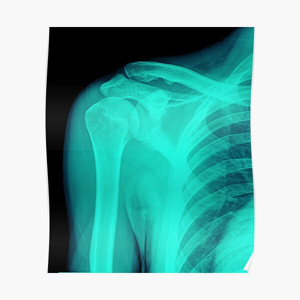 Funny X Ray Posters for Sale | Redbubble Funny X Ray Posters for Sale | Redbubble
