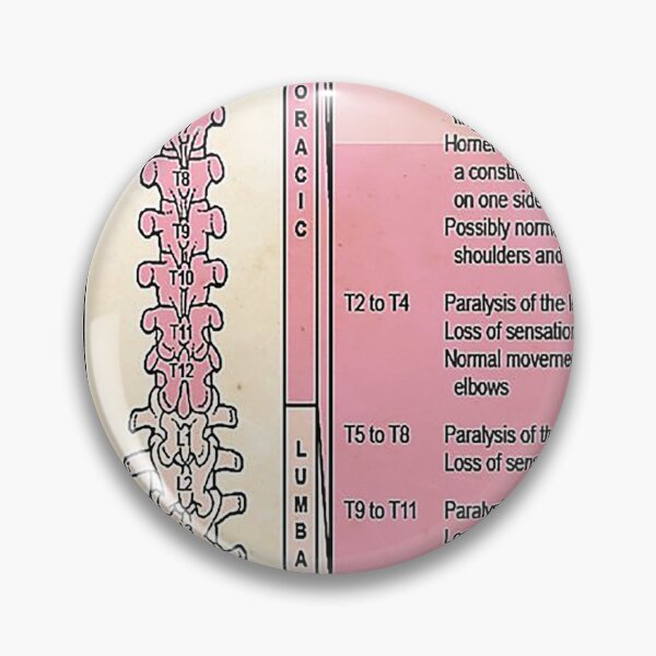 Item preview, effect of spinal injure chiro art designed and sold by Alexanderhishop.