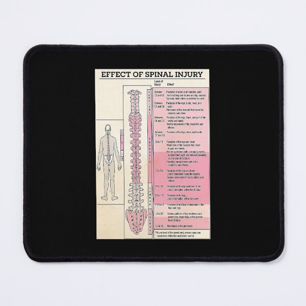 Item preview, effect of spinal injure chiro art designed and sold by Alexanderhishop.