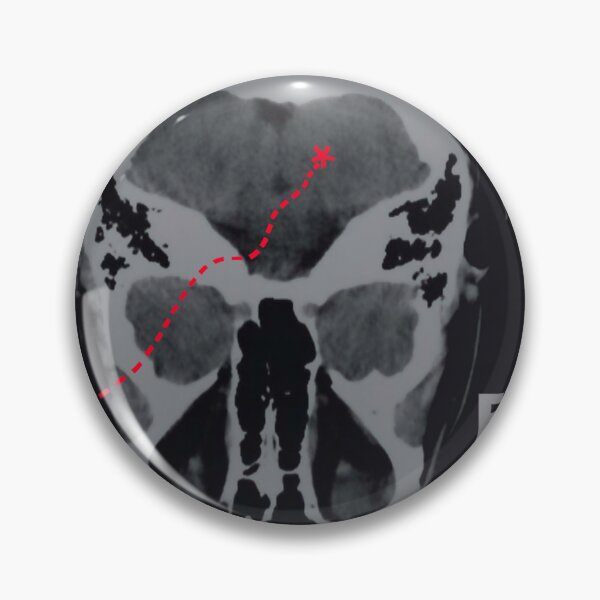 Item preview, Ben Folds way to normal (2) designed and sold by VanessaKelley.
