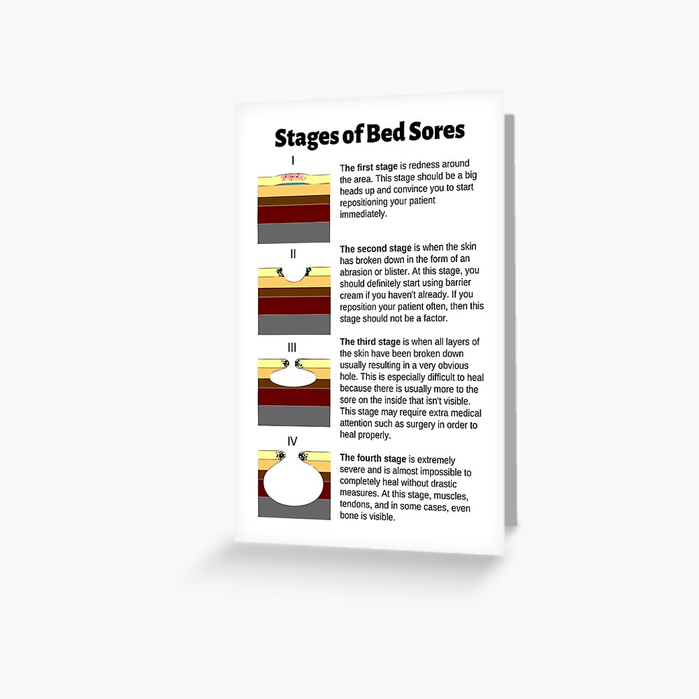 stages-of-bed-sores-chart-greeting-card-for-sale-by-caregiverology