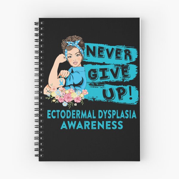 Item preview, Ectodermal Dysplasia Warrior - Never Give Up! - Support Ectodermal Dysplasia Warrior Gifts designed and sold by whlrcheryl.