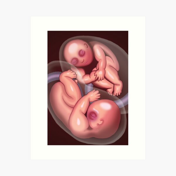 Item preview, Gemini - The Twin Babies, by Mustafa Kulle designed and sold by MustafaKulle.