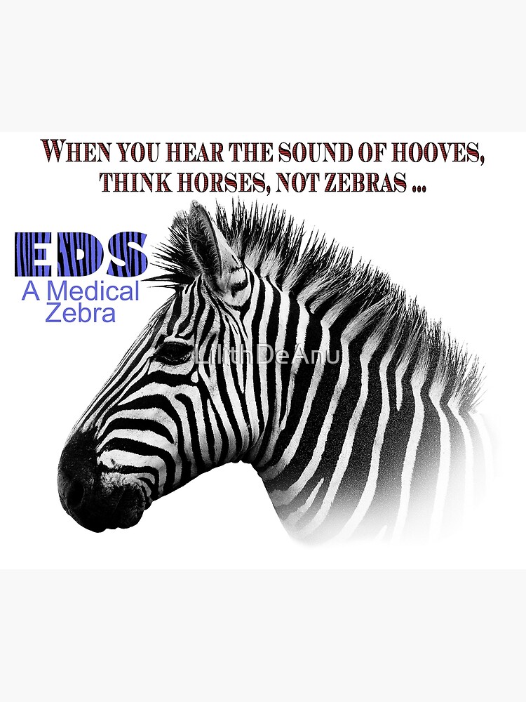 "EDS A Rare Medical Zebra" Poster by LilithDeAnu Redbubble