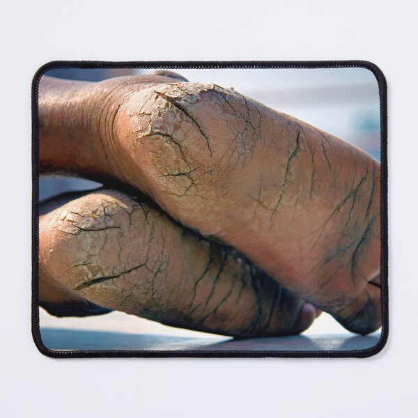 Item preview, Feet Cracks designed and sold by Momo-Stores.