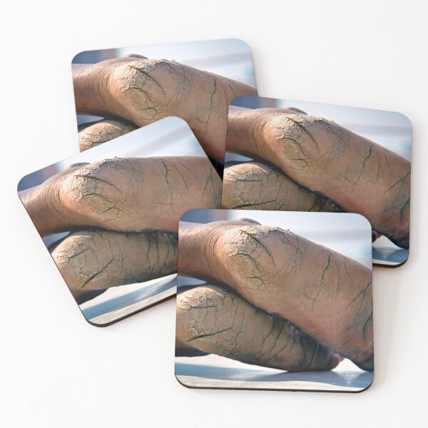 Item preview, Feet Cracks  designed and sold by Momo-Stores.