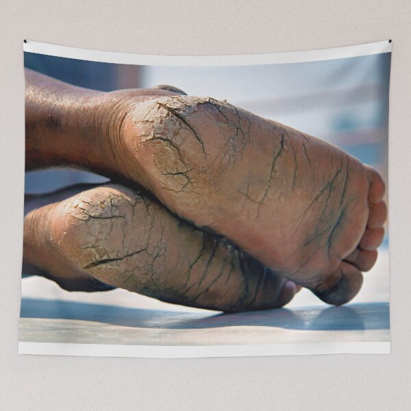 Item preview, Feet Cracks  designed and sold by Momo-Stores.