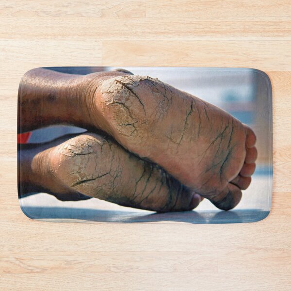Item preview, Feet Cracks  designed and sold by Momo-Stores.