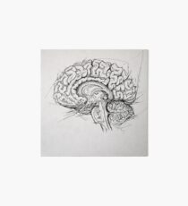 Brain Galeriedruck