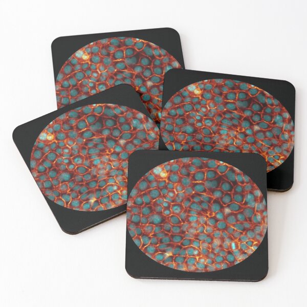 Item preview, Membranes and nuclei - icy hot blue and orange designed and sold by ArtByScience.