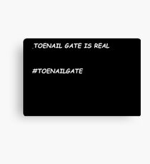 Lienzo Toenail Gate