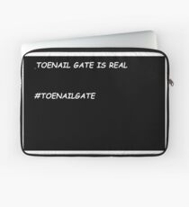Funda para portátil Toenail Gate