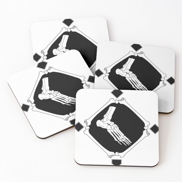 Item preview, The Dinger Ringers designed and sold by ravivyas.