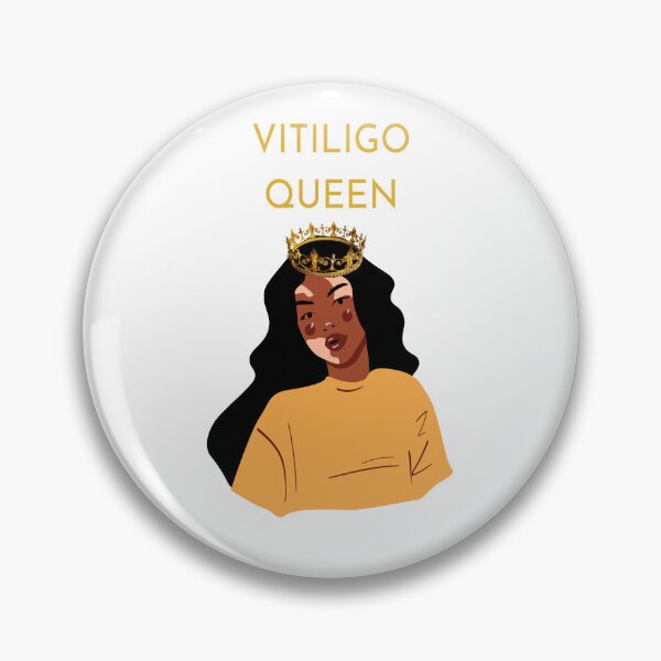 Item preview, VITILIGO QUEEN  designed and sold by DiscoVibes.