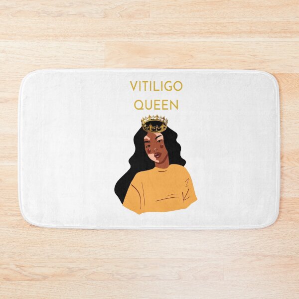 Item preview, VITILIGO QUEEN  designed and sold by DiscoVibes.
