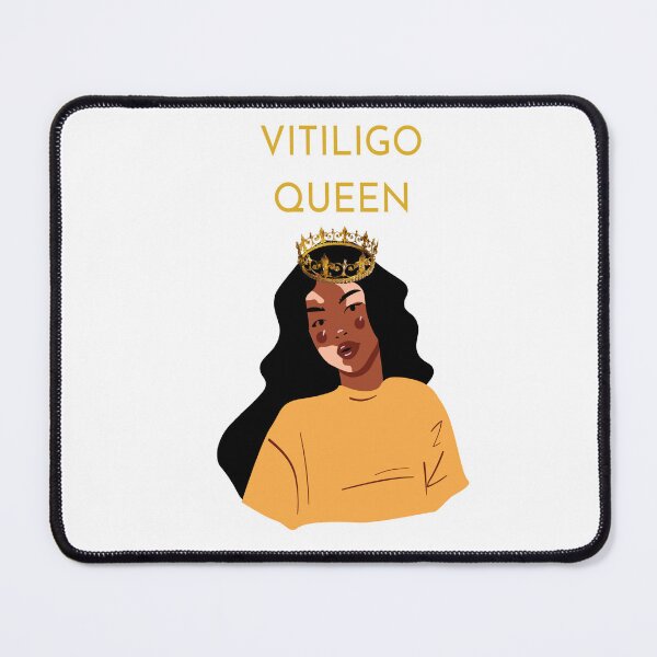 Item preview, VITILIGO QUEEN designed and sold by DiscoVibes.