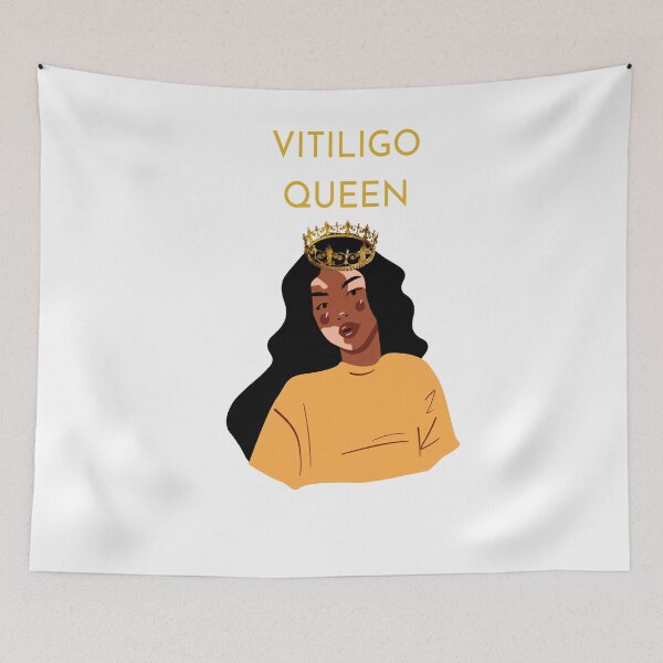 Item preview, VITILIGO QUEEN  designed and sold by DiscoVibes.