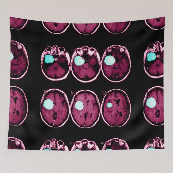 Item preview, MRI scan of a Brain Tumor, Medical Scan designed and sold by ScienceSource.