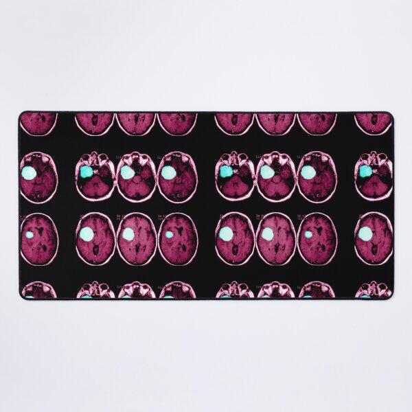 Item preview, MRI scan of a Brain Tumor, Medical Scan designed and sold by ScienceSource.