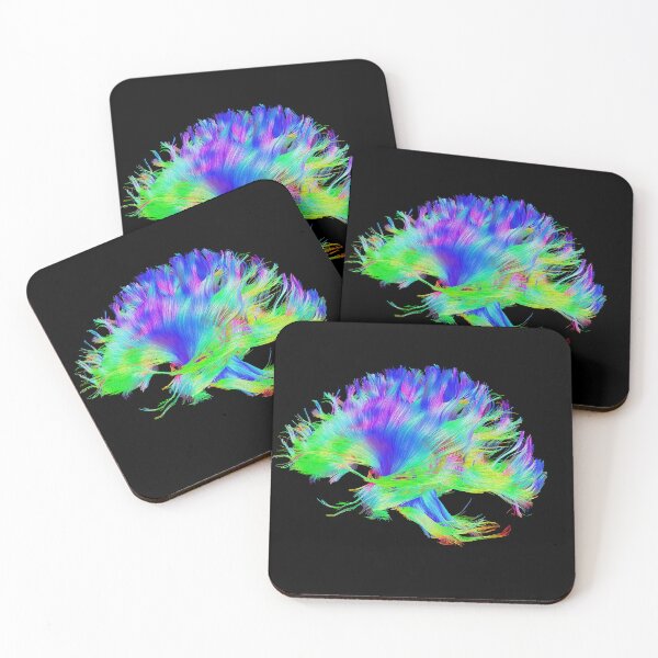 Item preview, Fiber Tracts Of The Brain, Dti, Medical Imaging Scan designed and sold by ScienceSource.