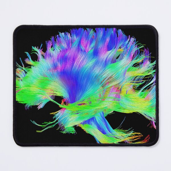 Item preview, Fiber Tracts Of The Brain, Dti, Medical Imaging Scan designed and sold by ScienceSource.