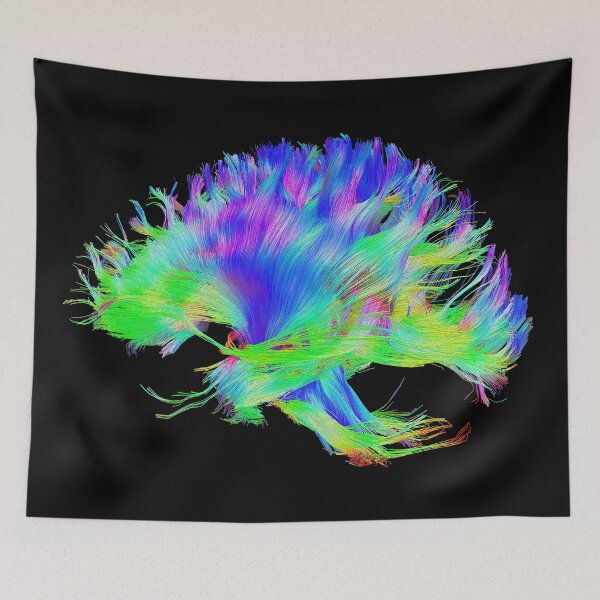 Item preview, Fiber Tracts Of The Brain, Dti, Medical Imaging Scan designed and sold by ScienceSource.