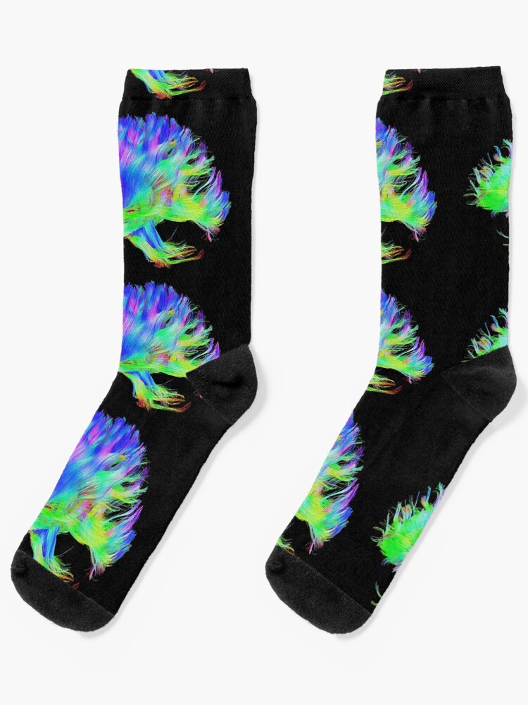 Fiber Tracts Of The Brain, Dti, Medical Imaging Scan