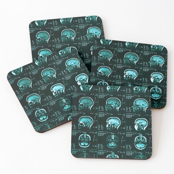 Item preview, Mri Of Normal Brain, Medical Imaging designed and sold by ScienceSource.