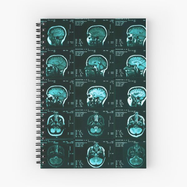 Item preview, Mri Of Normal Brain, Medical Imaging designed and sold by ScienceSource.