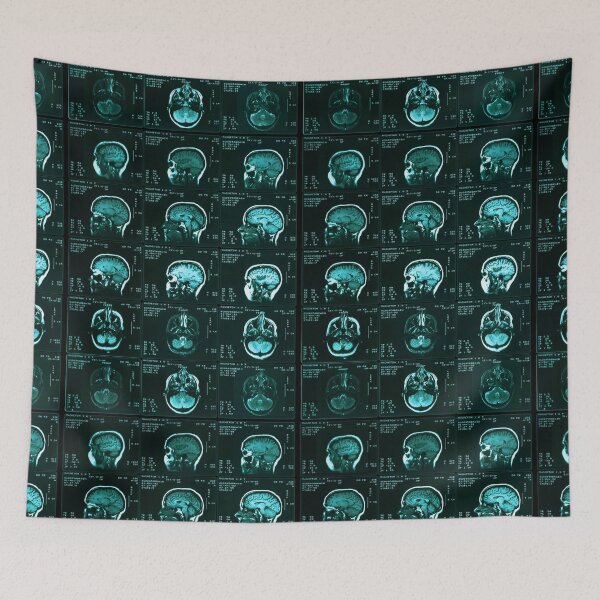 Item preview, Mri Of Normal Brain, Medical Imaging designed and sold by ScienceSource.