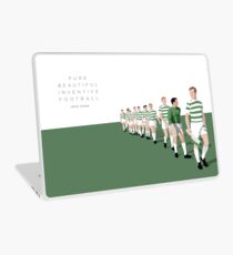 Pure Beautiful Inventive Football - Lisbon Lions Laptop Skin