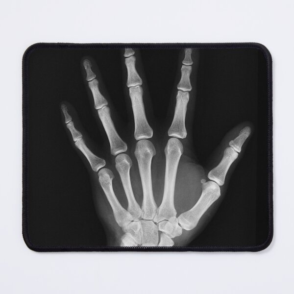 Item preview, Show me ur bones designed and sold by memedream.