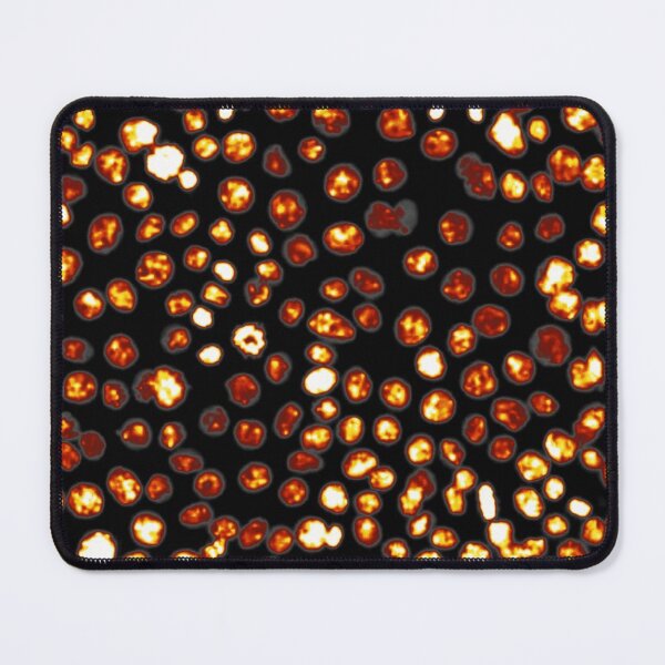 Item preview, Gold nuclei in epithelial cells. Express yourself with cellular biology! designed and sold by ArtByScience.