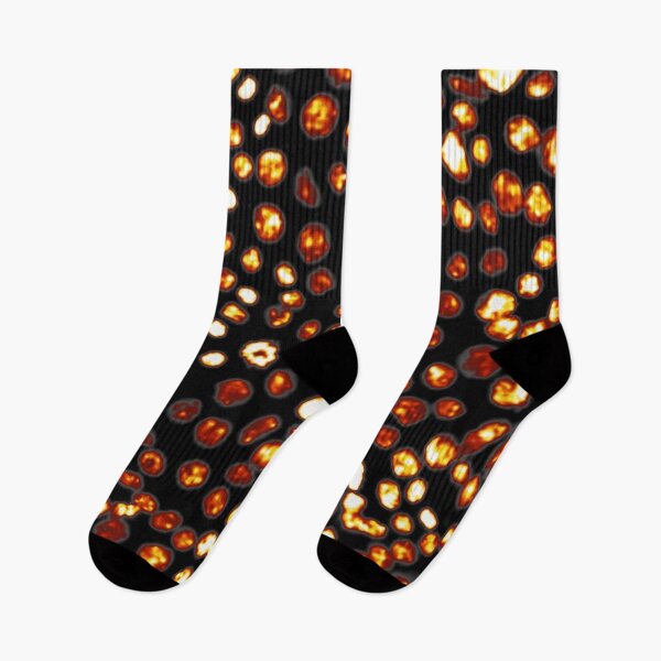 Item preview, Gold nuclei in epithelial cells. Express yourself with cellular biology! designed and sold by ArtByScience.