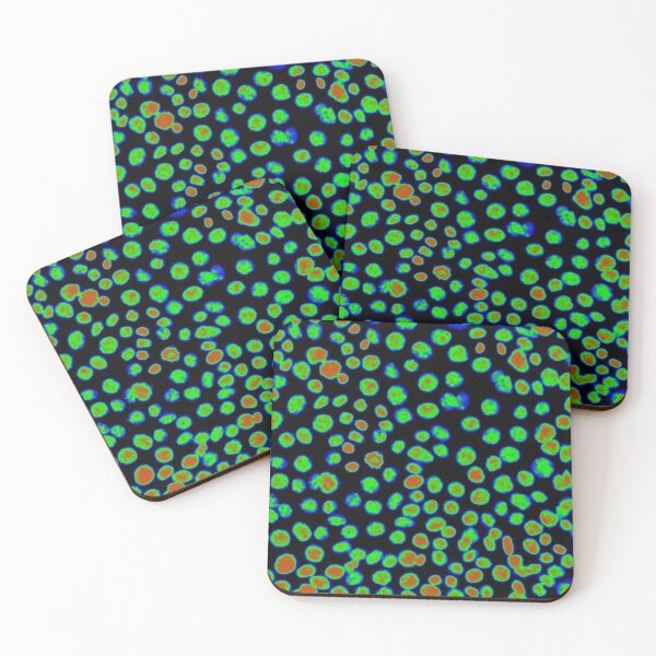 Item preview, Red and Green nuclei in epithelial cells. Express yourself with cellular biology! designed and sold by ArtByScience.