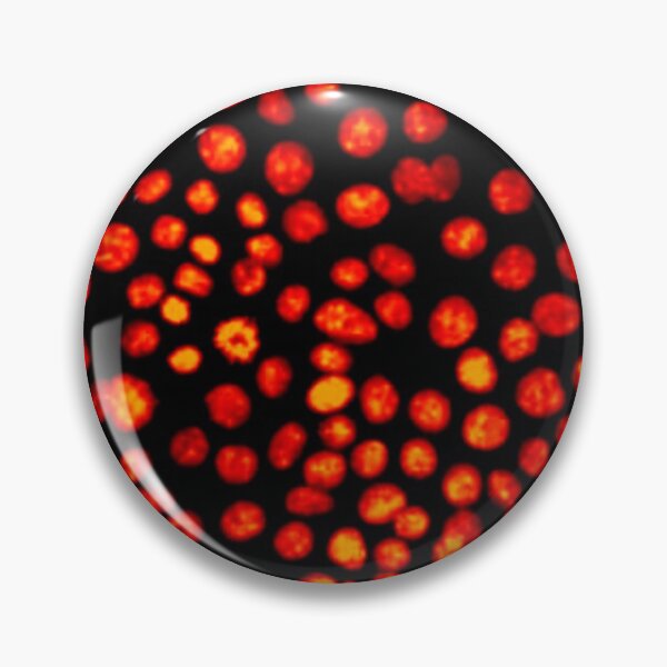 Item preview, Red hot nuclei in epithelial cells. Express yourself with cellular biology! designed and sold by ArtByScience.