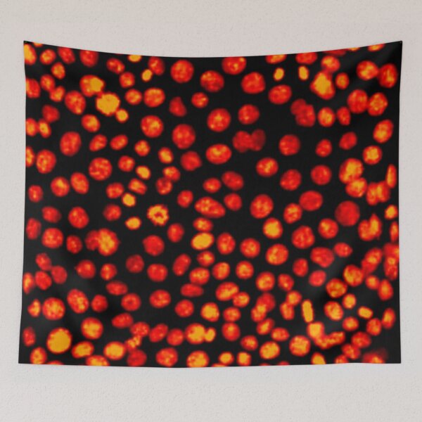 Item preview, Red hot nuclei in epithelial cells. Express yourself with cellular biology! designed and sold by ArtByScience.