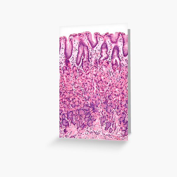 Artikel-Vorschau von Histologie des Magens, designt und verkauft von deltoid.