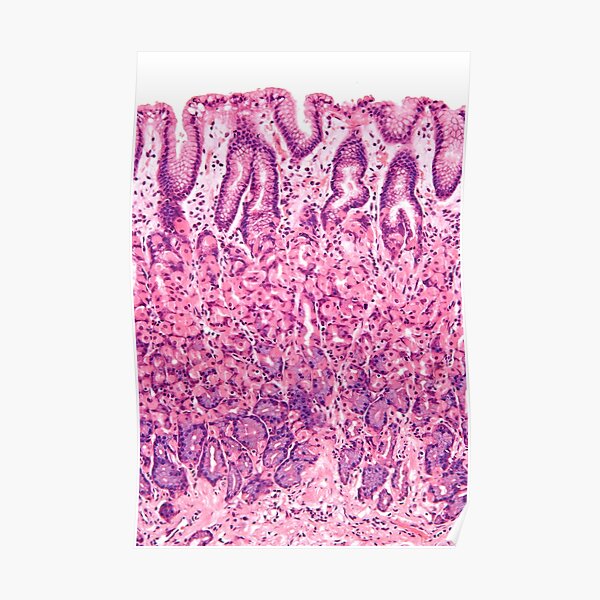 Stomach Histology Poster