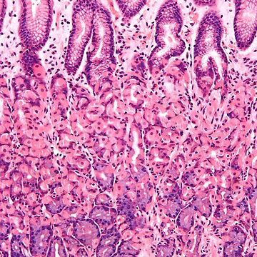 Aperçu de l'œuvre Histologie de l'estomac de deltoid